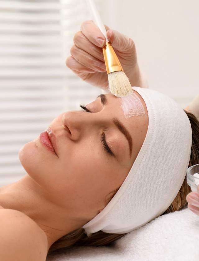Chemical Peel